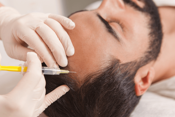 PRP Hair Treatment in Bangalore | Cost, Benefits & Results