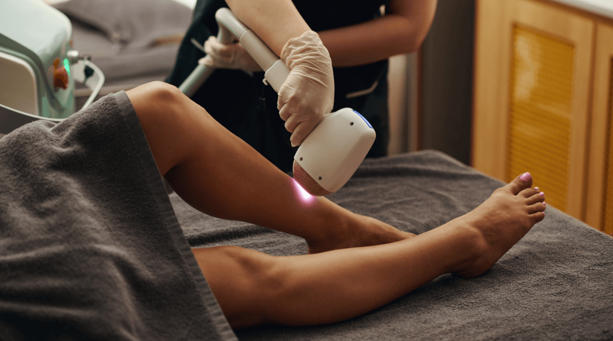 A Guide to Laser Hair Removal Treatment in Bangalore